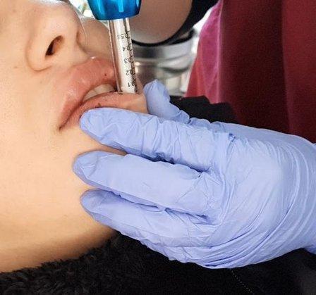 Estetica Avanzada Jenn Davis