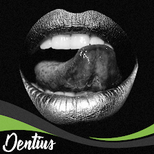 Dentius Vallecas