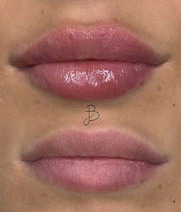 Bvega