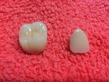 Laboratorio dental Jocar