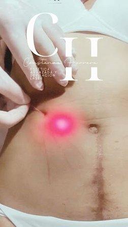 Centro de Estética y Depilación Láser | Constanza Herrera