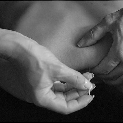 Fisioterapeutas Arroyomolinos - Energy Pilates