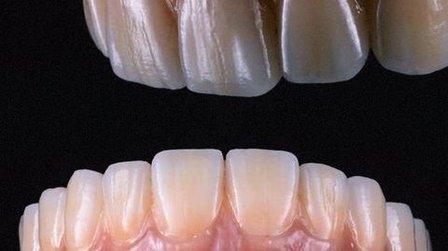 Ibero dental