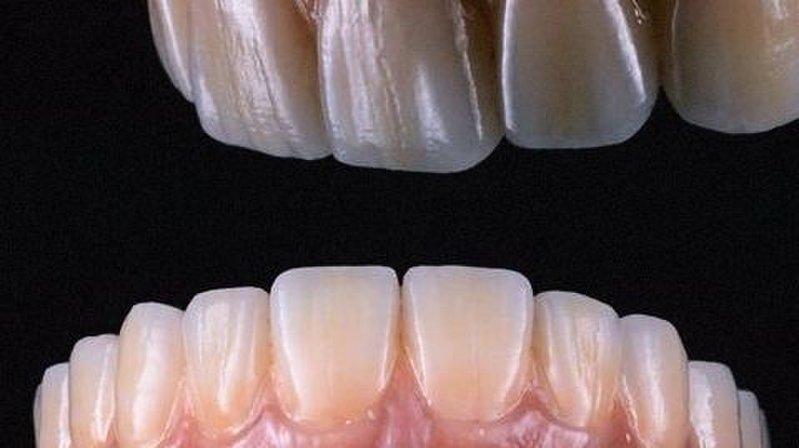Ibero dental