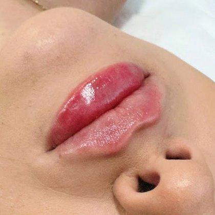 Dra. Miriam Chinchón | Medicina Estetica