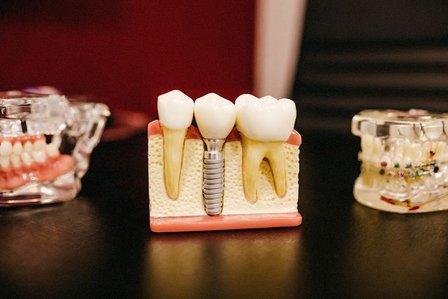 Dental Baires | Laboratorio Dental Madrid