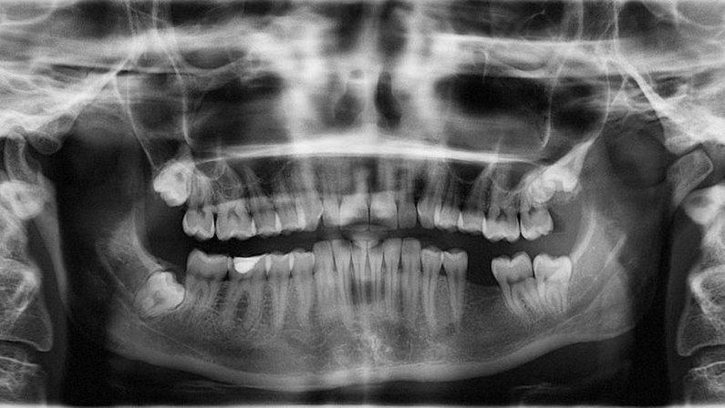Escaner Dental Sur