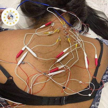 AUIMEC - UIMEC Asociación Unión Internacional Medicinas Complementarias Tratamientos y Cursos Acupuntura Madrid