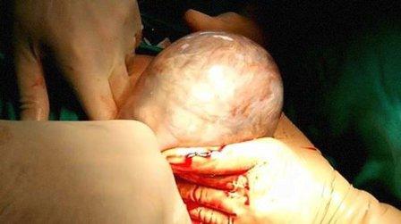 EGOM - Medical Equipment of Obstetrics and Gynecology