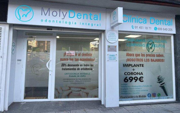 Molydental Leganés