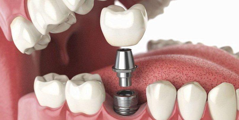 CENTRO MEDICO DENTAL Y MAXILOFACIAL ALCALA DE HENARES