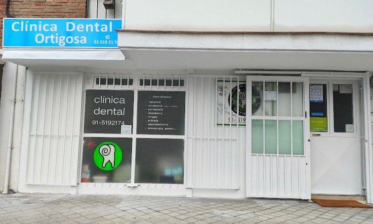 Clínica Dental Ortigosa | Clínica Dental en Arturo Soria