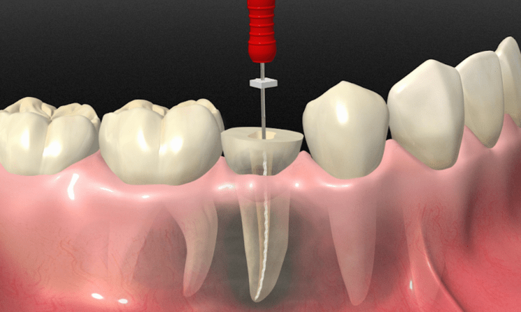 Dra. Rodriguez Rubio - Doctores Dental Torrejon