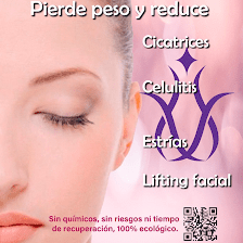Acupuntura Leganés RC