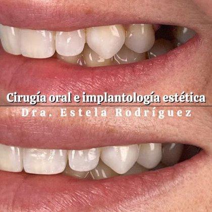 Clínica Dental Los Ángeles. Dra. Estela Rodríguez