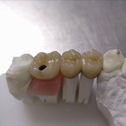 Laboratorio Ceramista Dental