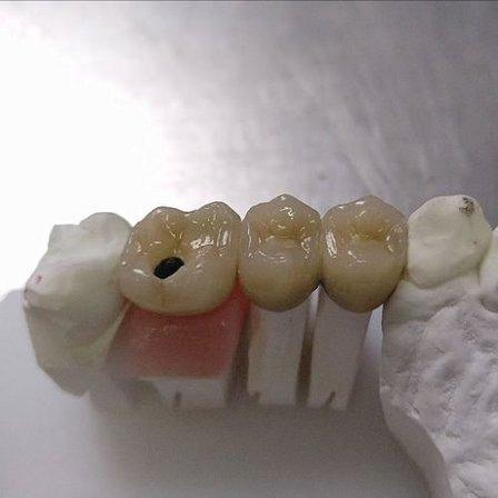 Laboratorio Ceramista Dental
