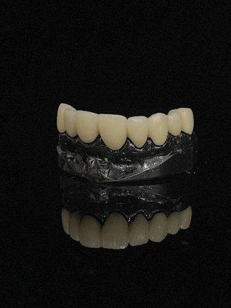 Yebra dental