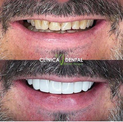 Clínica Dental Atención Sonrysas
