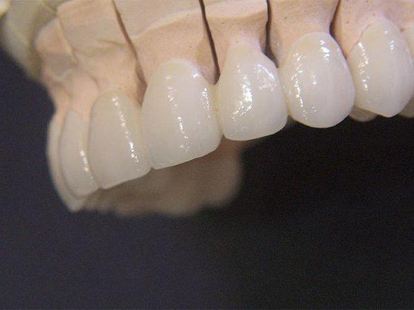 Laboratorio Dental Cortés Bergmann