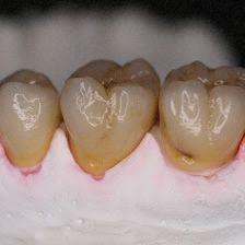 LABORATORIO DENTALJOAQUÍN MADRUEÑO ARRANZ