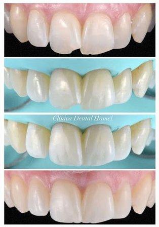 Clínica Dental Hamel