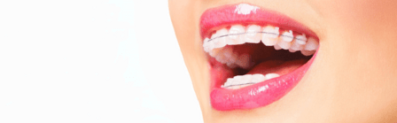 Clínica Dental Adelaida Parra - Dentista Torrelodones