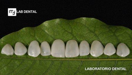 Laboratorio Dental My Lab Dental