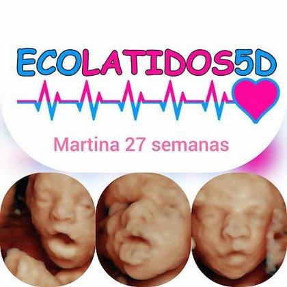 Ecolatidos 5D - Especialistas en Ecografia 5D y 4D