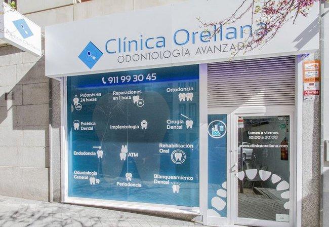 Clínica Dental Orellana Odontología Avanzada