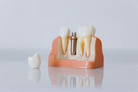 Grupo Clinico Dental Dr Borrega
