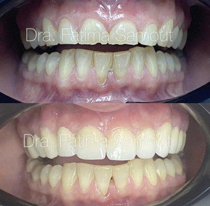 Sourident Clínica Dental