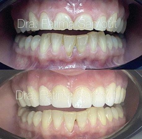 Sourident Clínica Dental