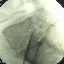OZONOTERAPIA INSTITUTO MADRILEÑO