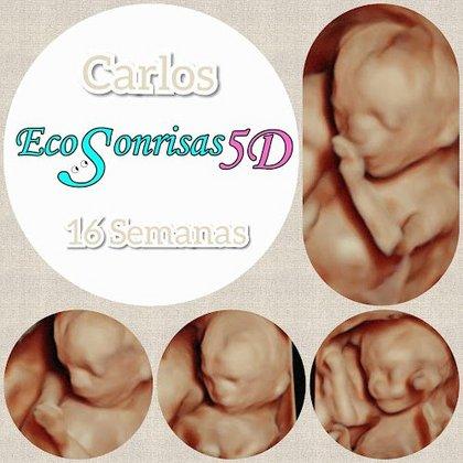 Ecosonrisas 5D Illescas - Especialistas en ecografía 5D y 4D